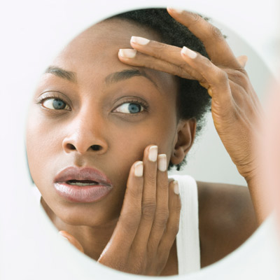 7 maneras de prevenir  y  eliminar los círculos  negros debajo de los&nbsp;ojos.